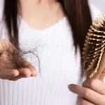 علل اصلی ریزش مو